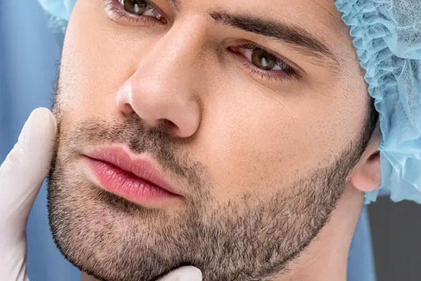 کاشت ریش و سبیل