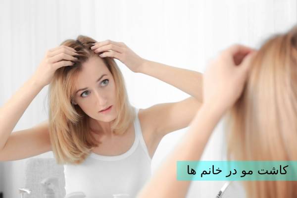 کاشت مو در خانم ها