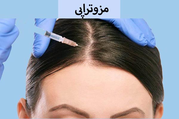 مزوتراپی