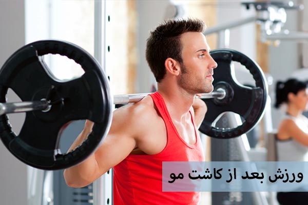 ورزش بعد از کاشت مو