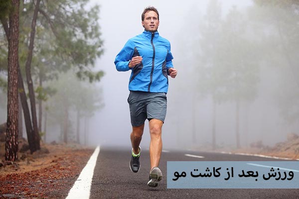 ورزش بعد از کاشت مو
